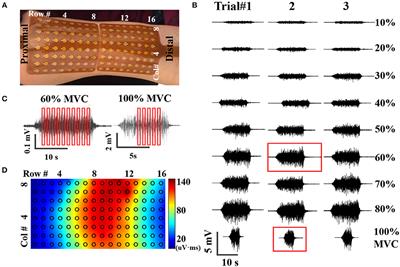 A Preliminary Study of Effects of Channel Number and Location on the Repeatability of Motor Unit Number Index (MUNIX)